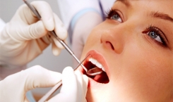 Răng khôn khi nào nên nhổ?